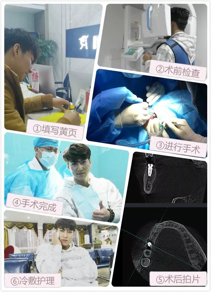 小“李敏镐”来咿呀口腔种牙了！