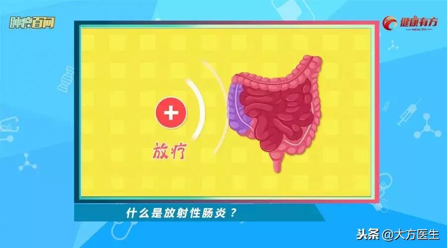 大肠癌早期做手术还是放疗好,大肠癌放疗期间注意事项