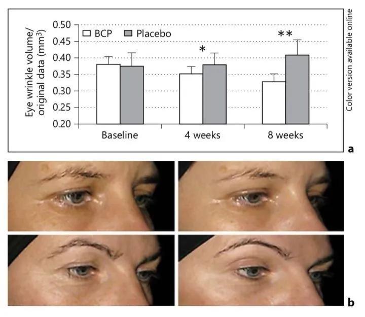 服用胶原蛋白到底有没有效？