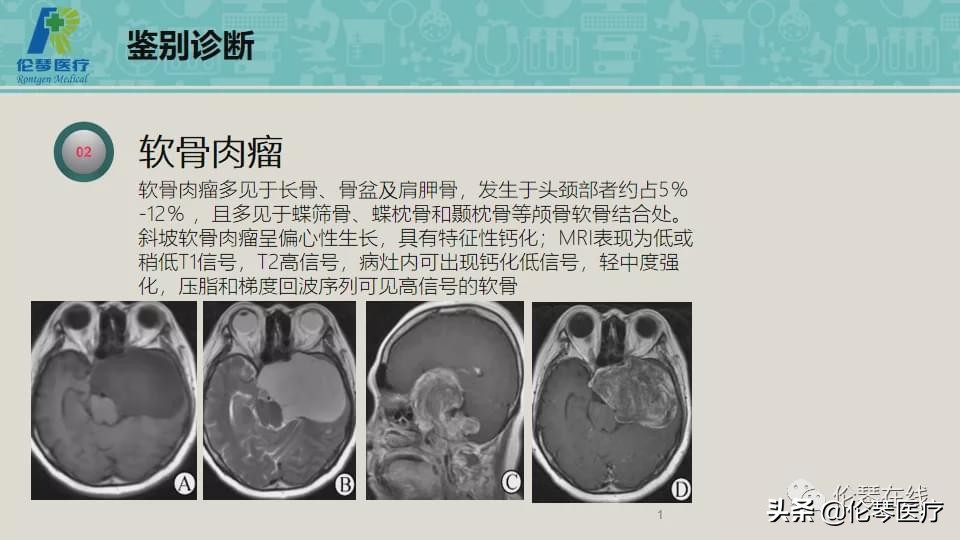 上海教授詹松华,上海曙光医院詹松华简介