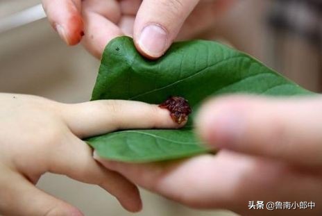 得了灰指甲一个传染俩靠谱吗,得了灰指甲一个传染两个