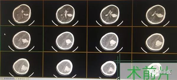 警惕熬夜,注意别仗着年轻就透支自己的身体