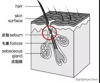 不靠谱的去黑头方法你试过哪几种,真假黑头教你如何正确去黑头