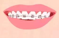 快看！这家店拯救了90%汕头人的牙齿烦恼