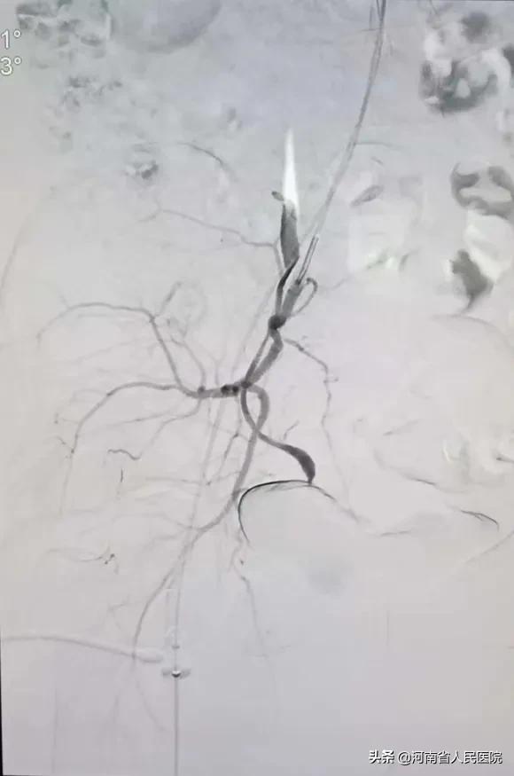 爬雪山过草地跨学科,爬雪山过草地历经二万五千里