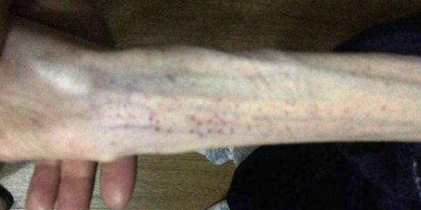 青春期子宫萎缩,女生三个月不吃晚饭真的会瘦吗