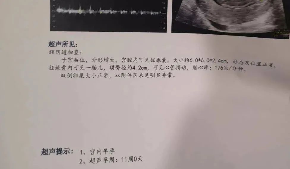 孕期一共做几次b超检查,孕期需要做几次b超检查