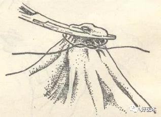 外科手术血管结扎法,外科血管止血结扎的基本操作