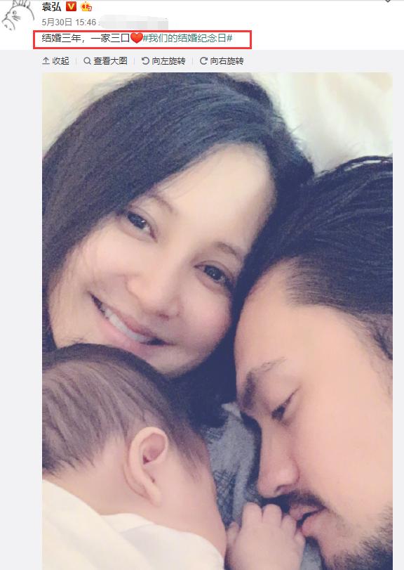 宝宝手指变异什么原因,宝宝手像猪蹄