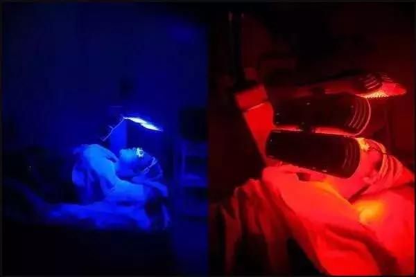 十年光学美容仪,初学者应该怎么选择美容仪