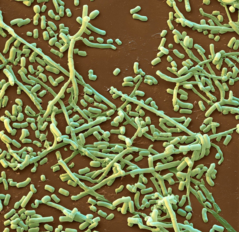 癣就是炎症引起的吗,癣是能治好吗