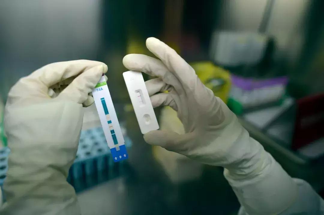 网上卖的艾滋病试纸是几代,网上卖的艾滋病试纸准确吗