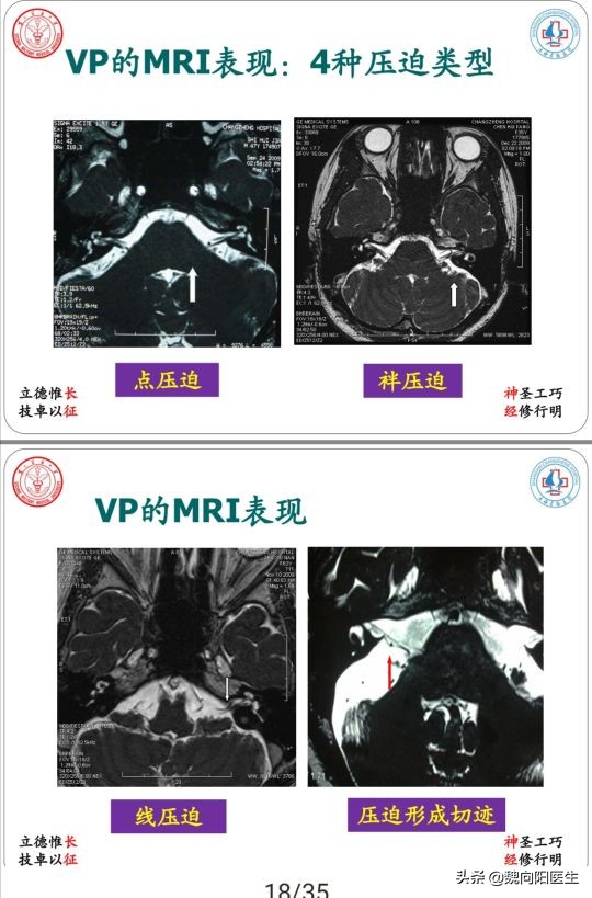 治疗眩晕头晕哪个医院好,头晕眩晕中医看什么科