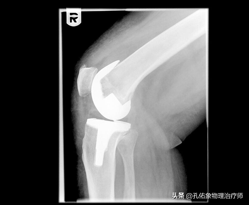 膝关节为什么疼,膝关节疼痛怎么治疗最好最有效