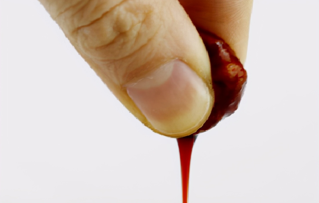 碘伏沾衣服上怎么洗下去,碘伏弄到衣服上用洗衣粉能洗掉吗