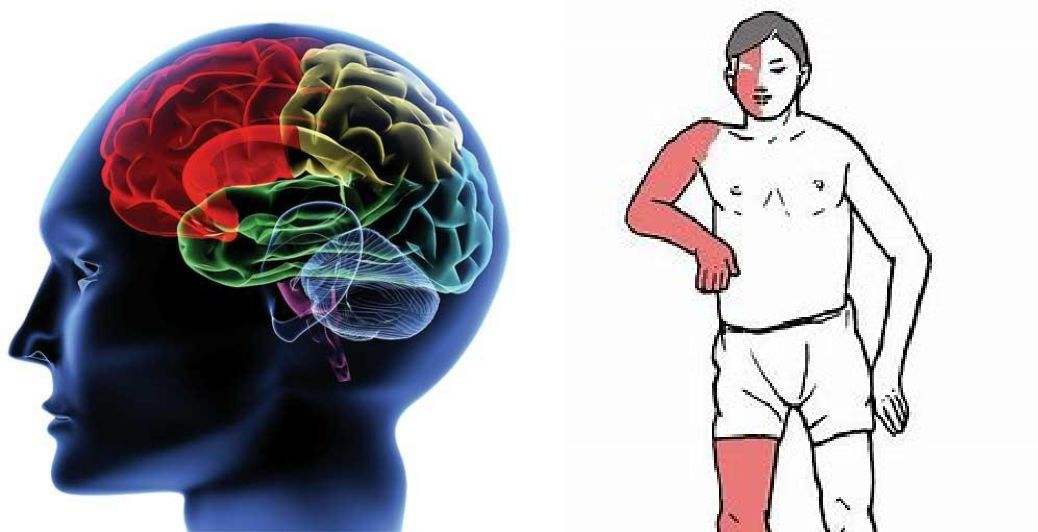 中风后遗症左脚前底板痛如何针灸,中风后遗症流涎的针灸治疗方法