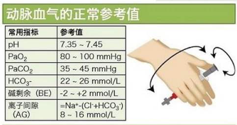 医学生教育系列知识一血气分析