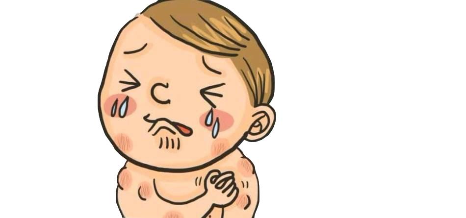 麻疹与荨麻疹的区别有哪些,冬季才会复发的荨麻疹怎么治