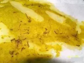 新手爸妈｜奶瓣、绿便、腹泻、便秘……宝宝各种便便真图全解必备