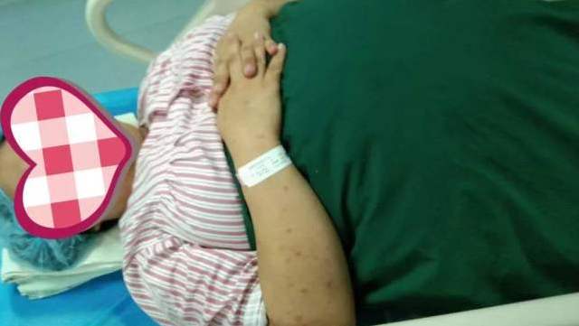 生孩子是在后背哪里打的麻药,生娃后背打麻药