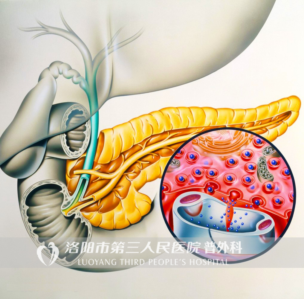 医学专家谈胰腺癌为什么这么可怕,为啥年轻人得了胰腺癌太惨了
