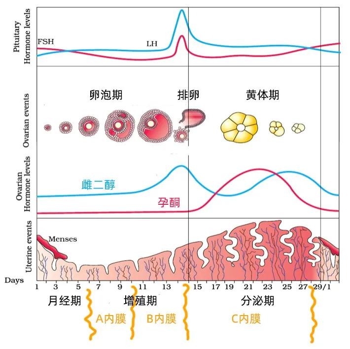 频繁出血的多囊和闭经型多囊，有什么不同？