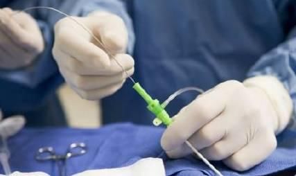 血管瘤术后留疤怎么去除,激光治疗血管瘤留疤么