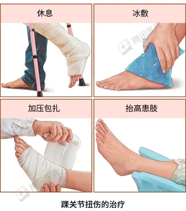 严重扭伤治疗,严重扭伤怎么处理