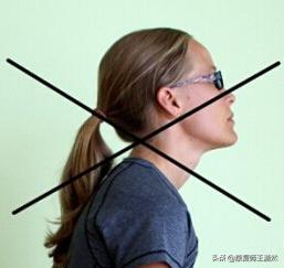 上交叉综合征多久能改善,上交叉综合征康复训练