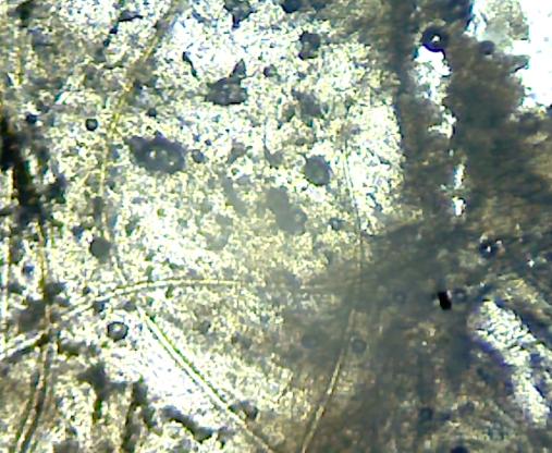 耳屎用显微镜放大是什么样,耳屎在显微镜下是不是活的