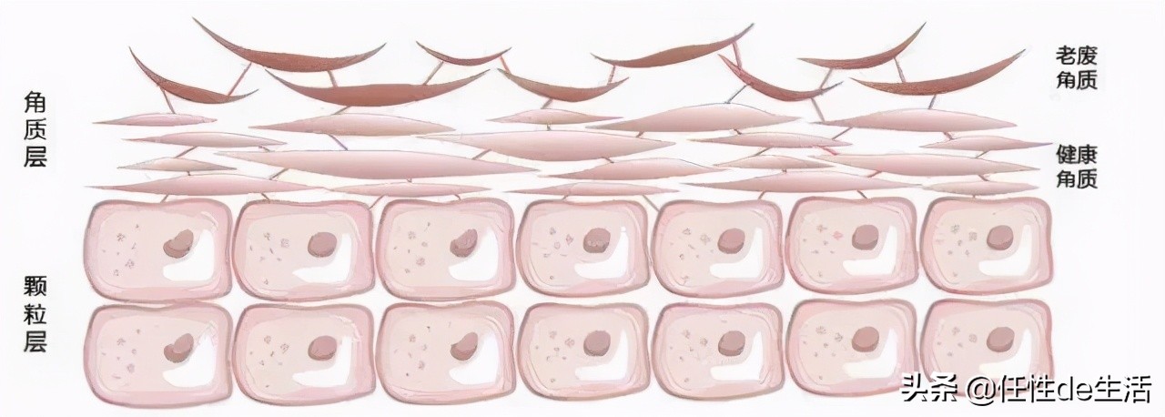 刷酸为什么避开脸颊,刷酸会脸垮吗