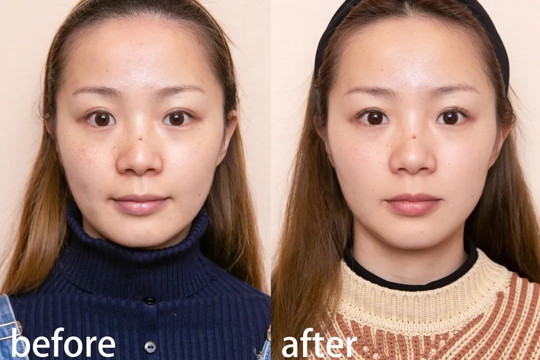 小茂医生美白护肤品,小茂教你如何护肤