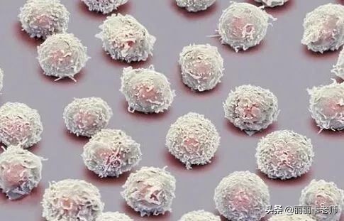 放疗后吃不进食物应该吃什么,放疗期间不想吃东西怎么办