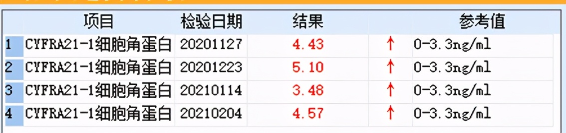 肺鳞癌介入治疗成功率,肺鳞癌最好的免疫化疗方案