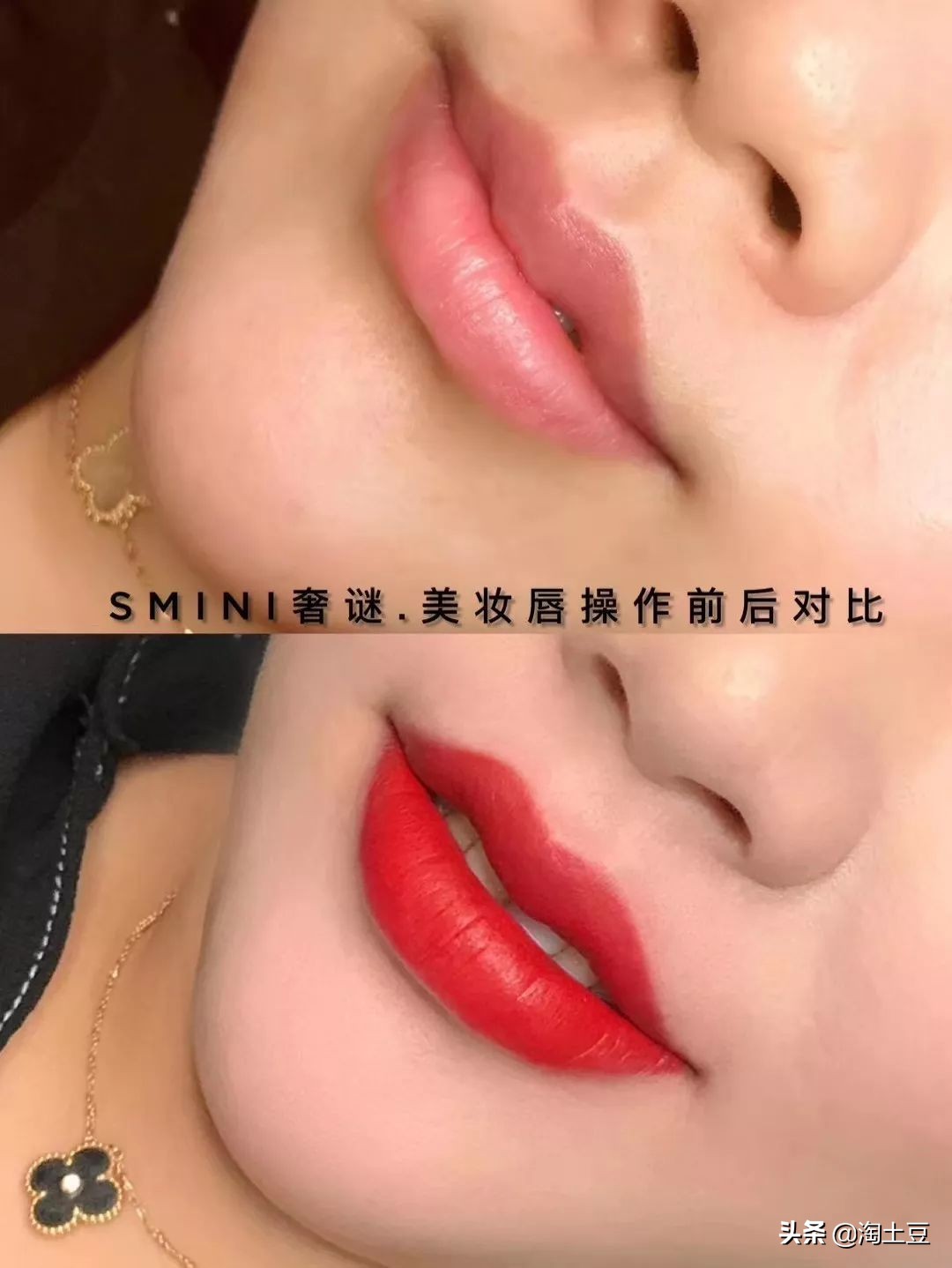 纹唇不肿,纹唇不肿不痛后期会上色吗