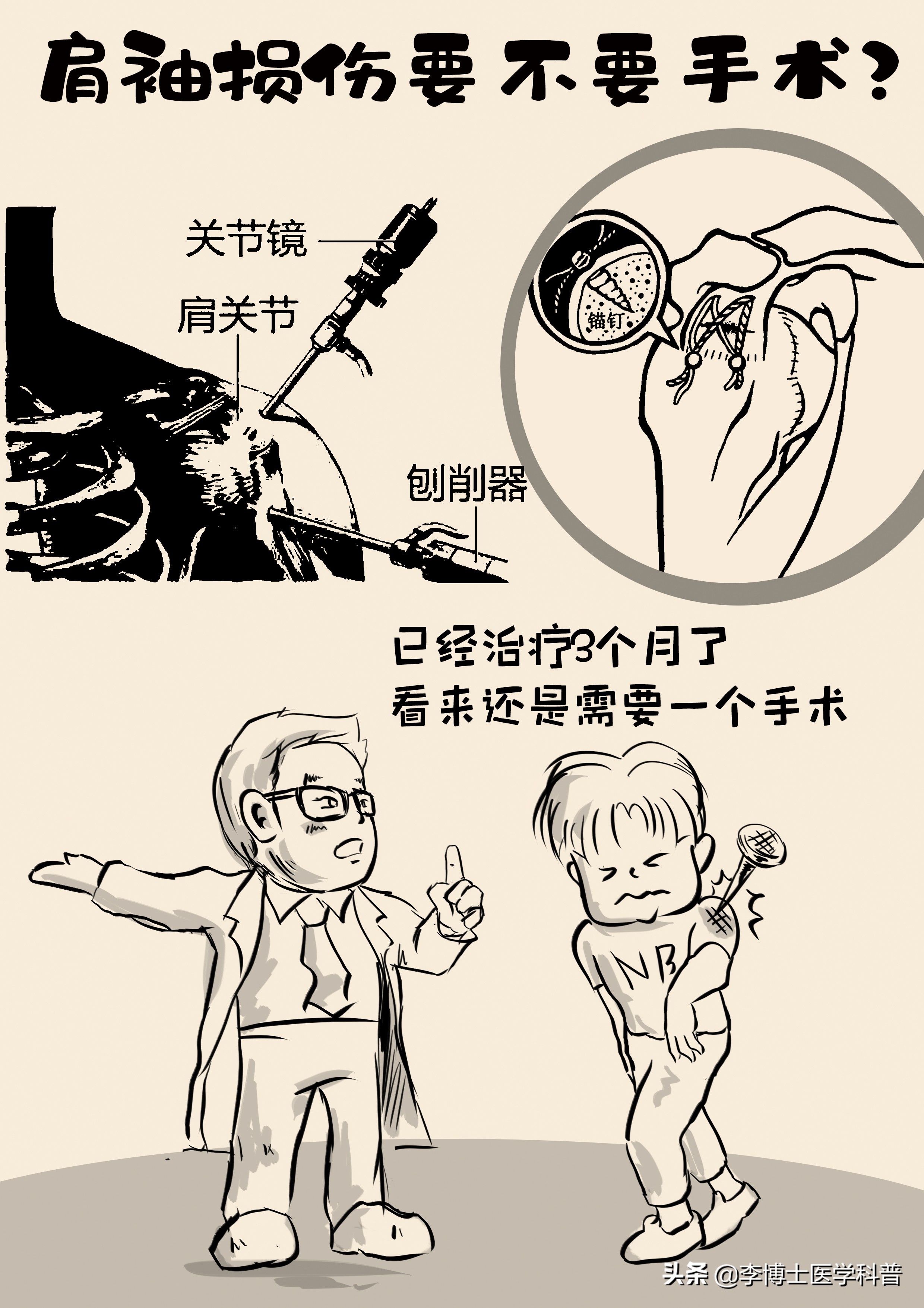 肩袖损伤保守治疗的正确方法,肩袖的概念及肩袖损伤的检查方法