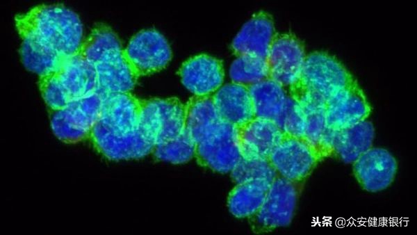 CAR-T疗法适用于哪些癌症,前景可观的car-t疗法