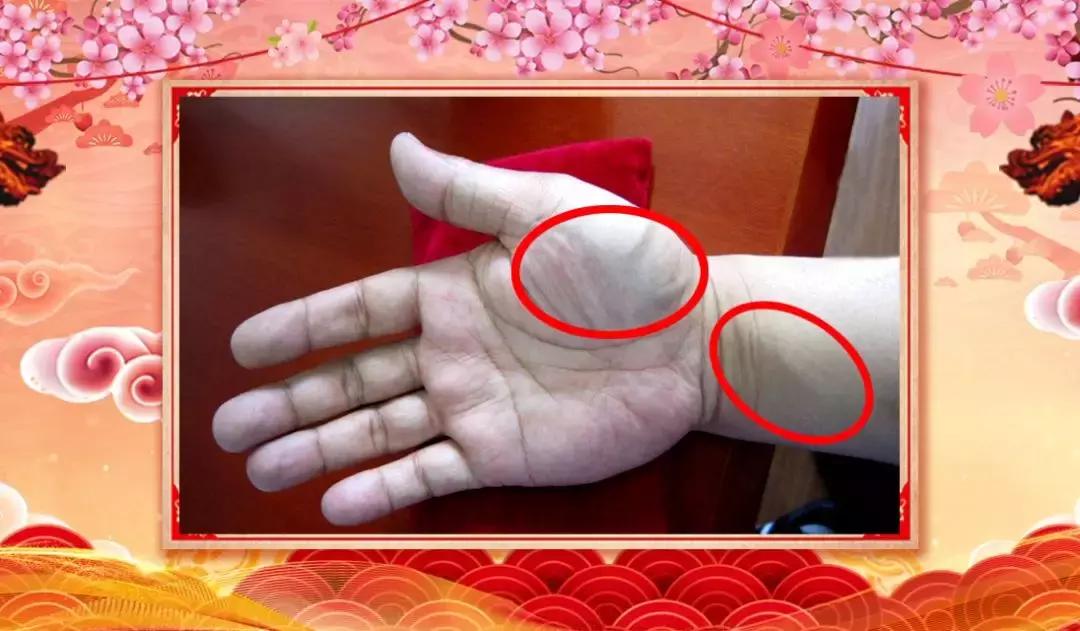 手心青筋突然发紫怎么回事,大鱼际青筋明显是心脏不好吗