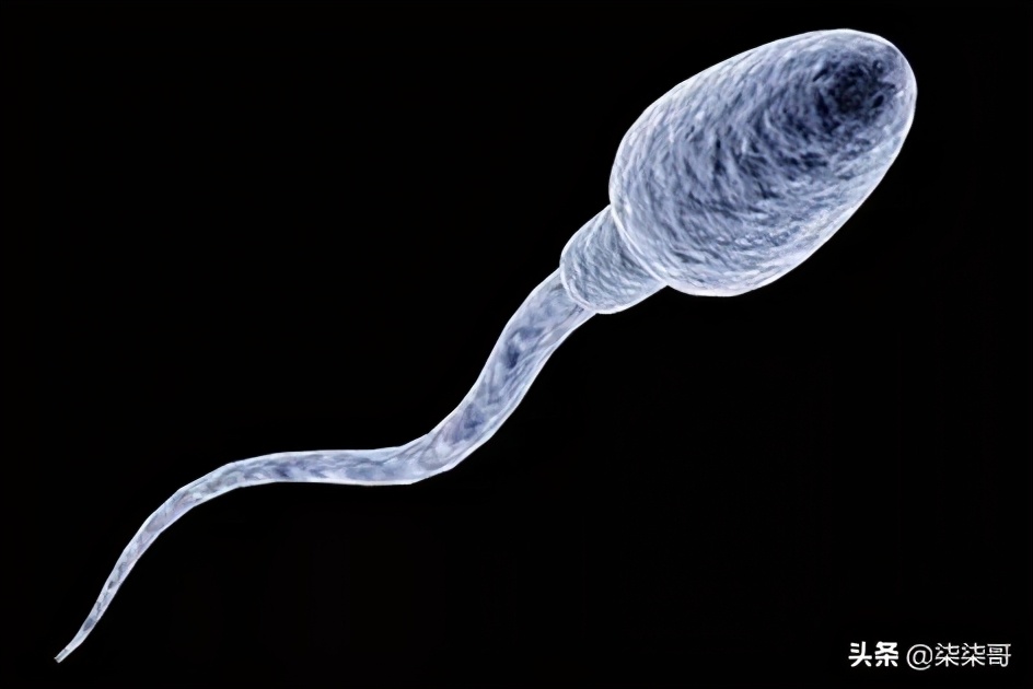 精子报告的解读,精子报告分析图形重要吗