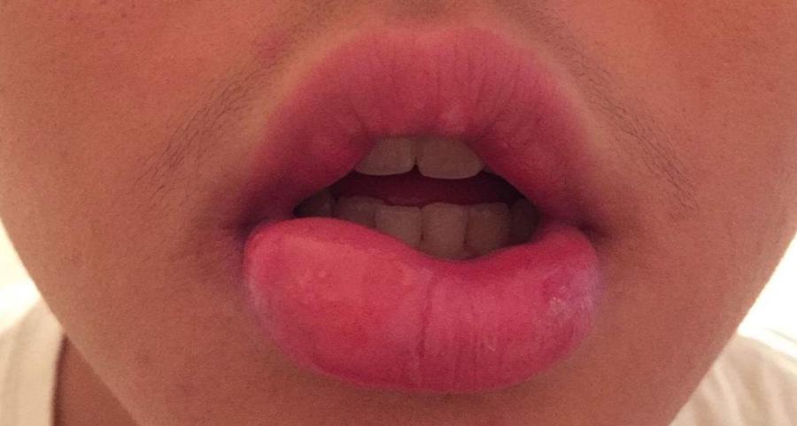 宝宝爱咬上嘴唇如何纠正,小孩喜欢咬嘴唇睡觉变龅牙