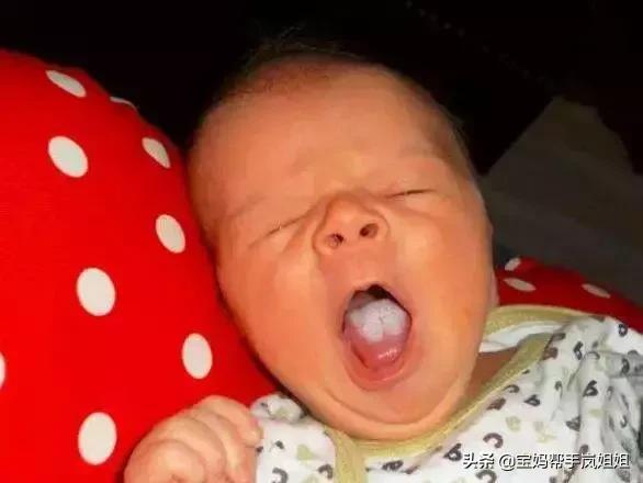 新生宝宝长鹅口疮怎么办,治疗鹅口疮常见药物