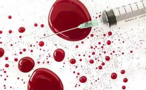 艾滋病日保护好自己远离病毒传染,世界艾滋病日与蜂共舞