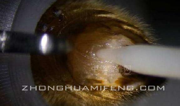 铚傜帇鐨勫偍绮惧泭,涓渹绮惧瓙鍌ㄥ瓨