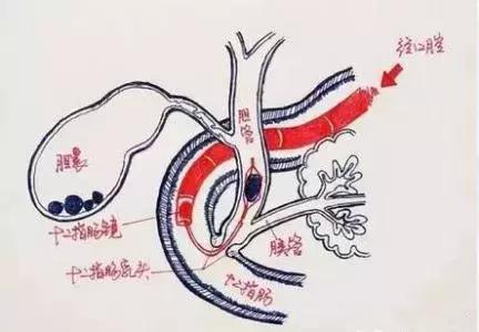 当正常肠道变身迷宫，如何在45分钟“走出”？