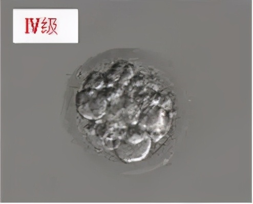 胚胎评级4bc什么意思,胚胎以什么标准评级