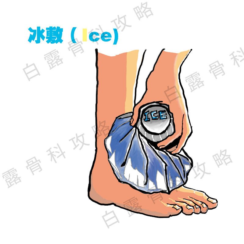 急性踝关节扭伤后的正确处理方法,踝关节扭伤要冰敷几次
