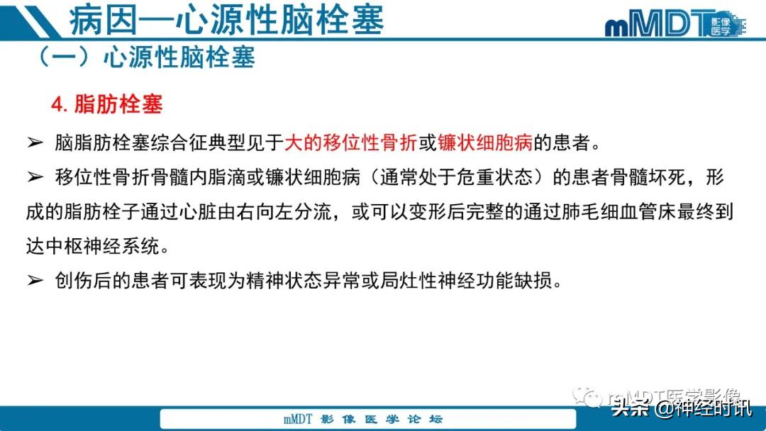 急性缺血性脑卒中ppt素材图片,青年缺血性脑卒中ppt