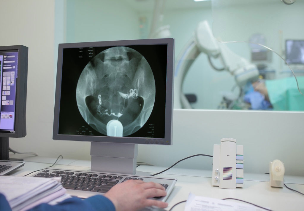 输卵管造影检查前能吃早餐吗,输卵管造影能检查卵巢功能吗