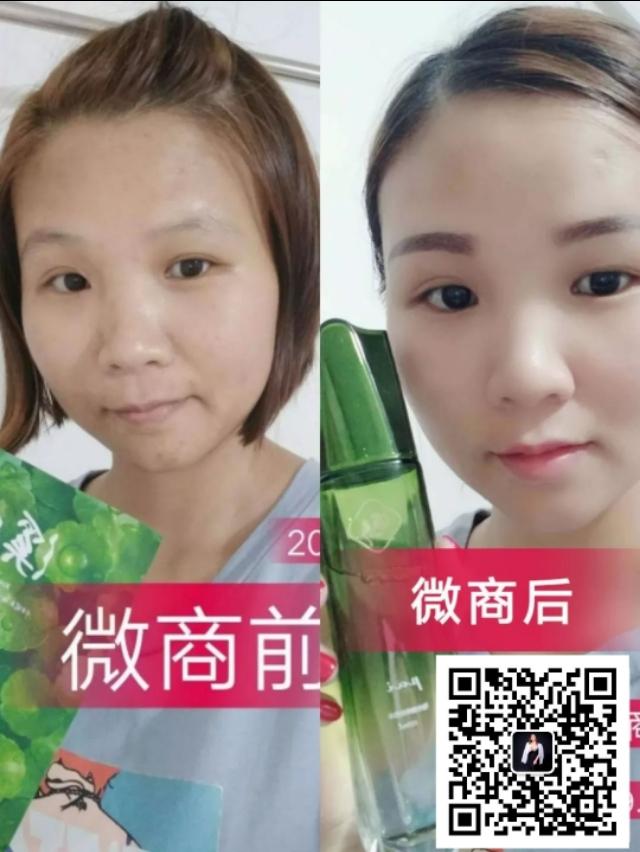 溪秀面膜补水,溪秀淡斑面膜