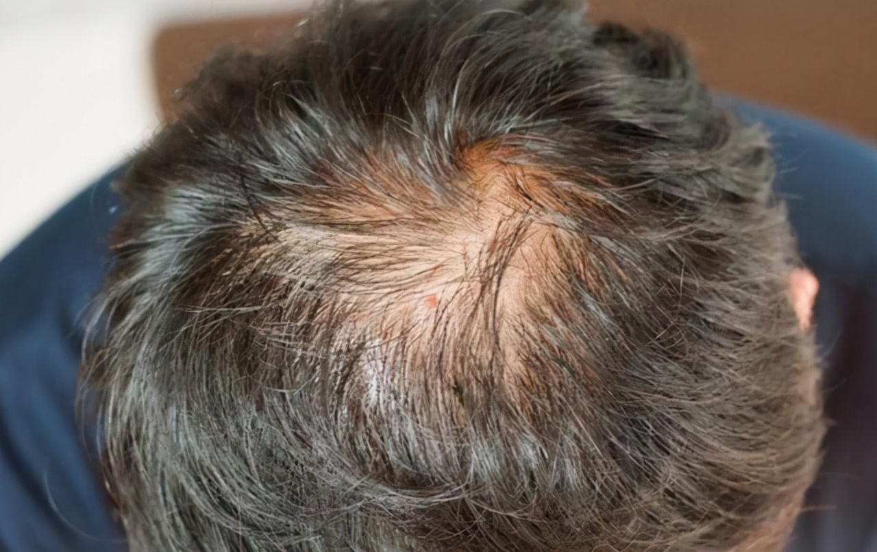 男性肾透支怎么调理,肾严重透支的5个信号你占几个